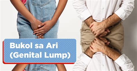 bulitas sa ari meaning|Butlig Sa Ari O Genital Warts: Paano ito Maiiwasan at .